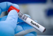 Sífilis