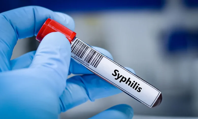 Sífilis