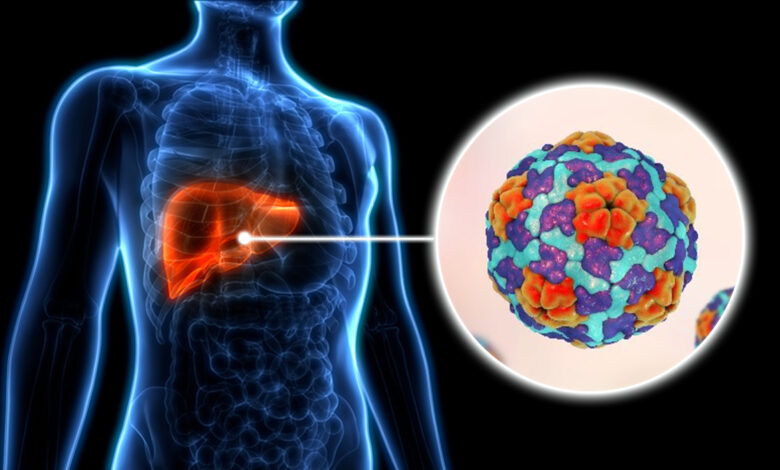 Hepatitis