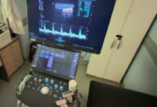 Nuevo Ecógrafo Hospital Houssay