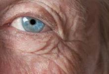 Ojo de adulto mayor