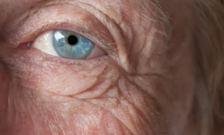 Ojo de adulto mayor